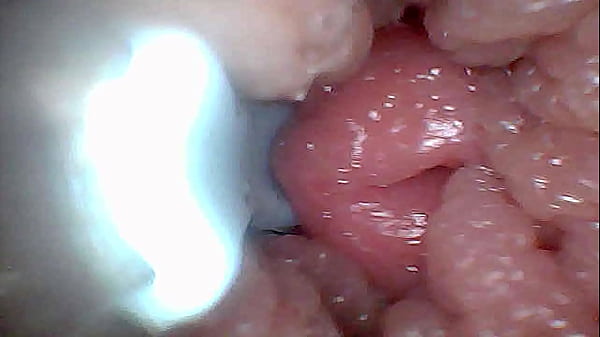 Guía visual para la estimulación del punto G y el orgasmo y mdash_ perspectiva endoscópica